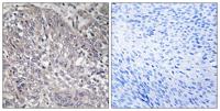 IP3R-I Polyclonal Antibody