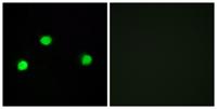 IP6K2 Polyclonal Antibody