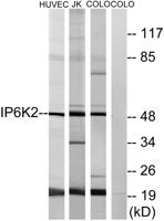 IP6K2 Polyclonal Antibody