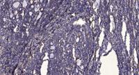 iPLA2γ Polyclonal Antibody