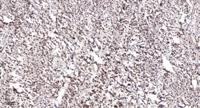 IPMK Polyclonal Antibody