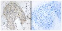 IPP-2 Polyclonal Antibody