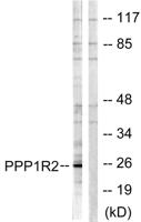 IPP-2 Polyclonal Antibody