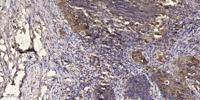IRAK-1 Polyclonal Antibody