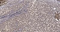 IRAK-2 Polyclonal Antibody