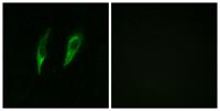 IRAK-M Polyclonal Antibody