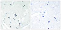 IRAK-M Polyclonal Antibody