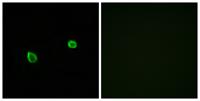 IREβ Polyclonal Antibody