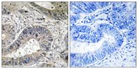 IREβ Polyclonal Antibody