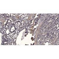 IRF-1 Polyclonal Antibody