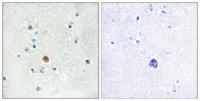 IRF-3 Polyclonal Antibody
