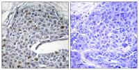 IRF-3 Polyclonal Antibody