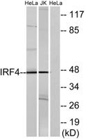 IRF-4 Polyclonal Antibody