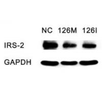 IRS2 Polyclonal Antibody