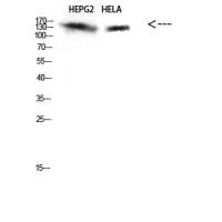 IRS2 Polyclonal Antibody
