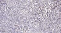 IRTKS Polyclonal Antibody