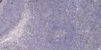 IRX1 Polyclonal Antibody