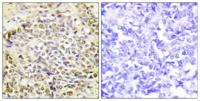 IRX2 Polyclonal Antibody