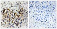 IRX3 Polyclonal Antibody