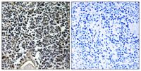 ABCB7 Polyclonal Antibody
