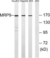 ABCC12 Polyclonal Antibody