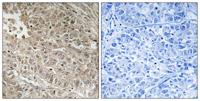 ABCC13 Polyclonal Antibody