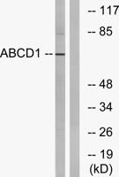 ABCD1 Polyclonal Antibody