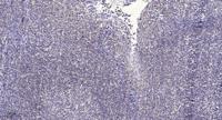 ABCD4 Polyclonal Antibody