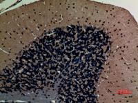 ABCG1 Polyclonal Antibody