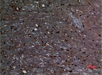ABCG1 Polyclonal Antibody