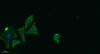 ABCG5 Polyclonal Antibody