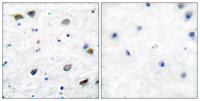 GABAA Rβ1 Polyclonal Antibody