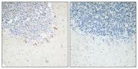 GABAA Rβ2 Polyclonal Antibody