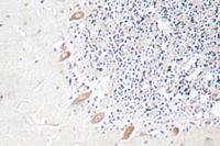 GABAA Rβ2 Polyclonal Antibody