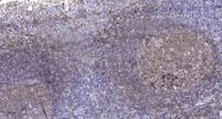 GABAA Rδ Polyclonal Antibody