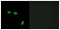 GABAB R1 Polyclonal Antibody