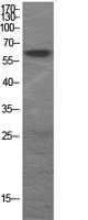 GAD-65/67 Polyclonal Antibody