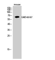 GAD-65/67 Polyclonal Antibody