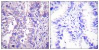 GAD-65/67 Polyclonal Antibody