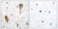 GAD67 Polyclonal Antibody