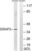 Gads Polyclonal Antibody