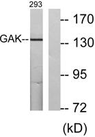 GAK Polyclonal Antibody