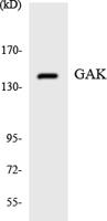 GAK Polyclonal Antibody