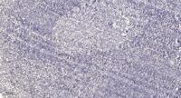 GAK Polyclonal Antibody