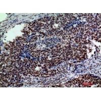 Galactosidase β Polyclonal Antibody