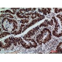 Galactosidase β Polyclonal Antibody