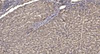 ITPK1 Polyclonal Antibody