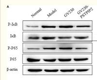 IκB-α Polyclonal Antibody