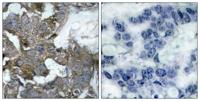 IκB-α Polyclonal Antibody