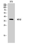 IκB-β Polyclonal Antibody